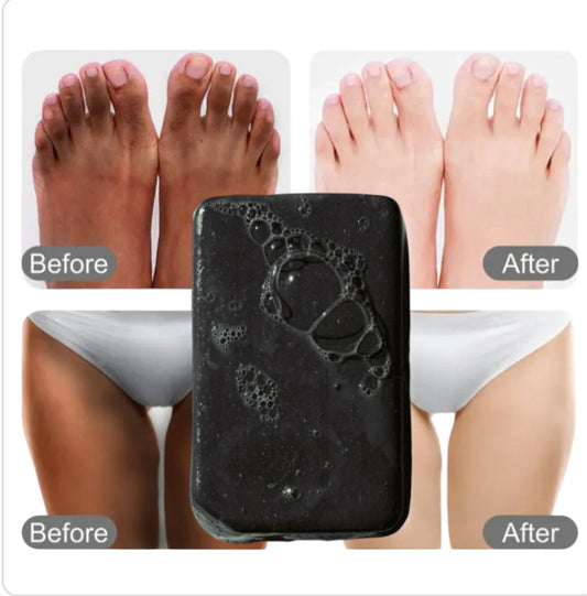 KNUCKLE REMOVER WHITENING SOAP