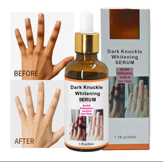 Dark knuckles serum.