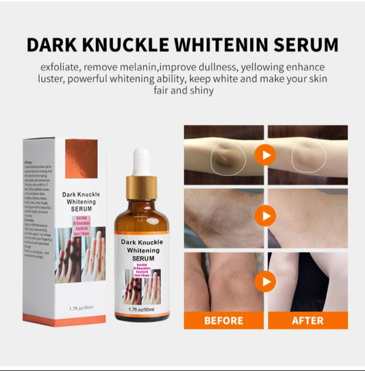 Dark knuckles serum.